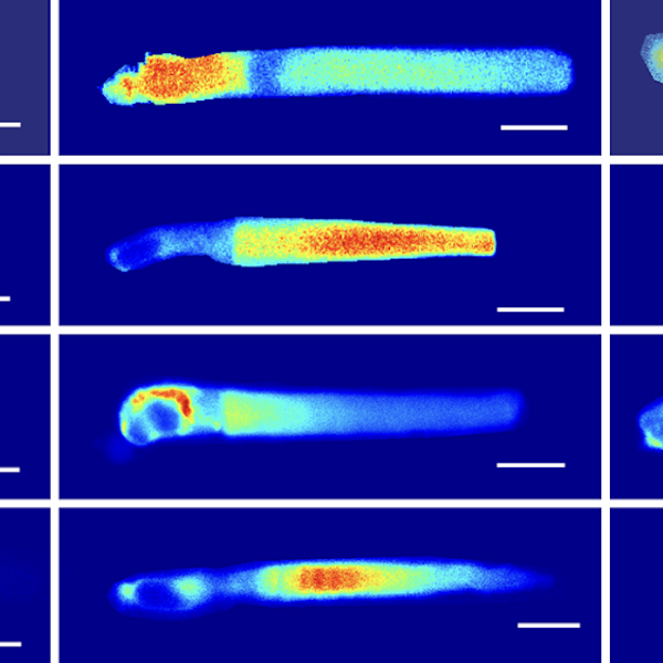 Montage of confocal images of living Xenopus rods expressing EGFP probes